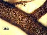 4 - Cellule corticali in visione superficiale
